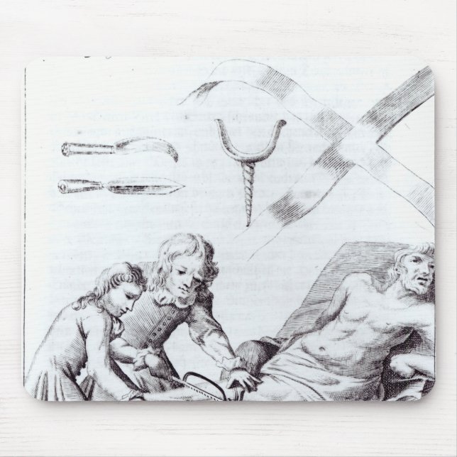 Mousepad Operação cirúrgica para amputar um pé (Frente)