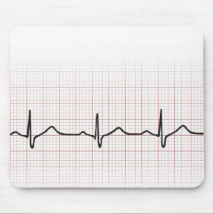 Mousepad Pulsação do coração no papel de gráfico, puls