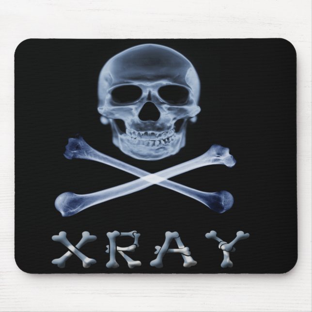 Mousepad RADIOLOGIA ROGER ALEGRE da bandeira de PIRATA do (Frente)