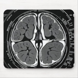 Mousepad ressonância magnética cerebral