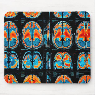 Mousepad ressonância magnética cerebral