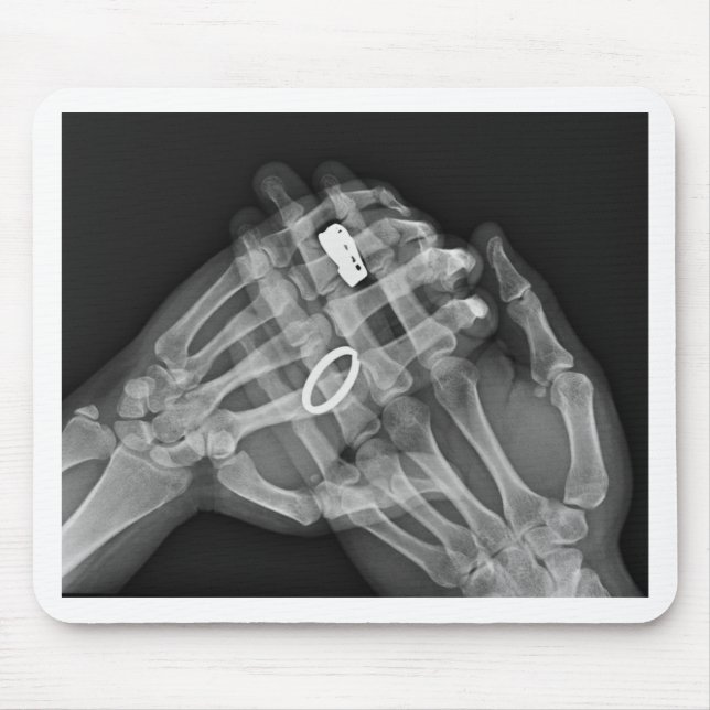 Mousepad Terra arrendada da mão (Frente)