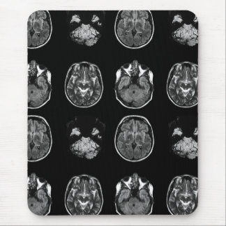 Mousepad Varredura por ressonância magnética do cérebro