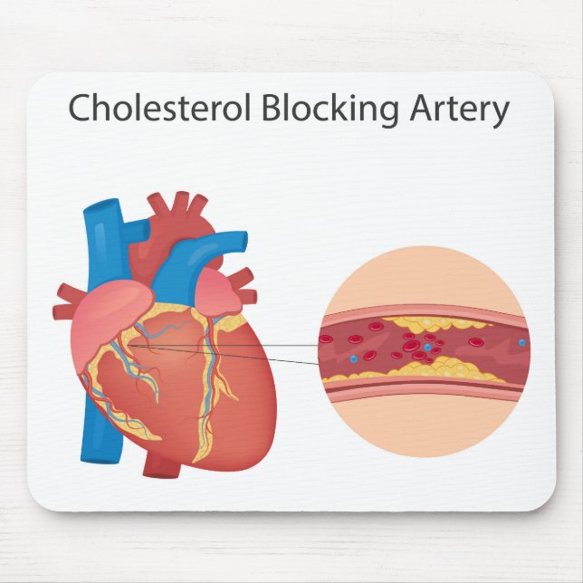 Mousepad Vasos sanguíneos estreitos (Frente)