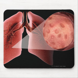 Mousepad Via aérea de Inflammed durante um ataque de asma