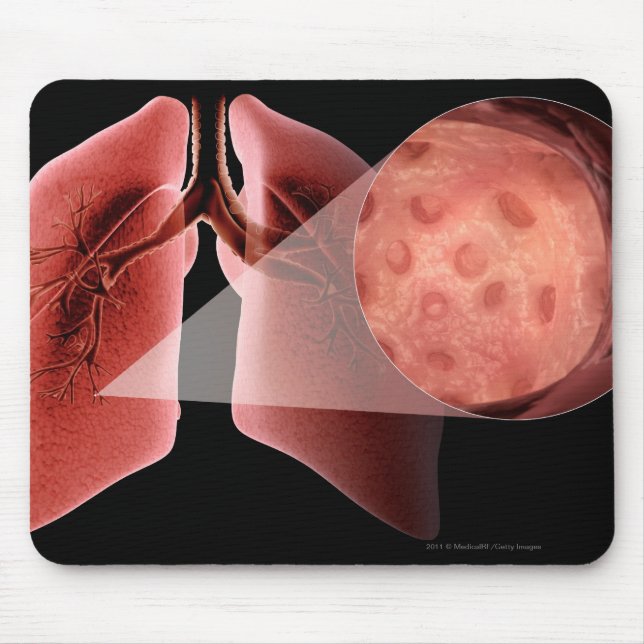 Mousepad Via aérea de Inflammed durante um ataque de asma (Frente)
