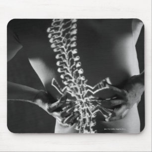 Mousepad Vista da corda espinal