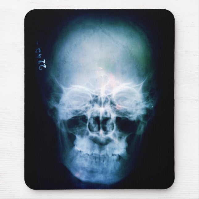 Mousepad X-Cabeça (Frente)