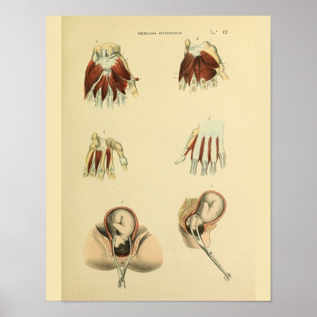 Nascimentos Obstetrícia Anatomia Impressão de Arte (Frente)