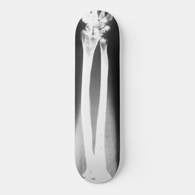 O skate Breaks de Bradley Boness (Frente)