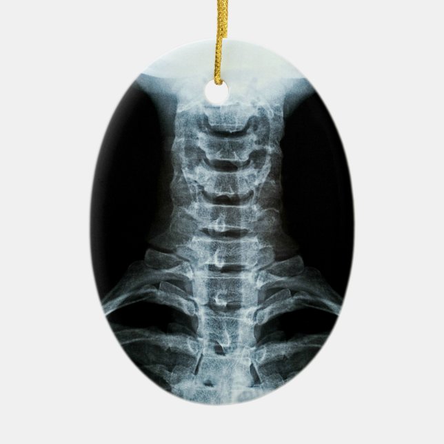 Ornamento De Cerâmica Arte do raio X de Digitas (texto traseiro do (Frente)