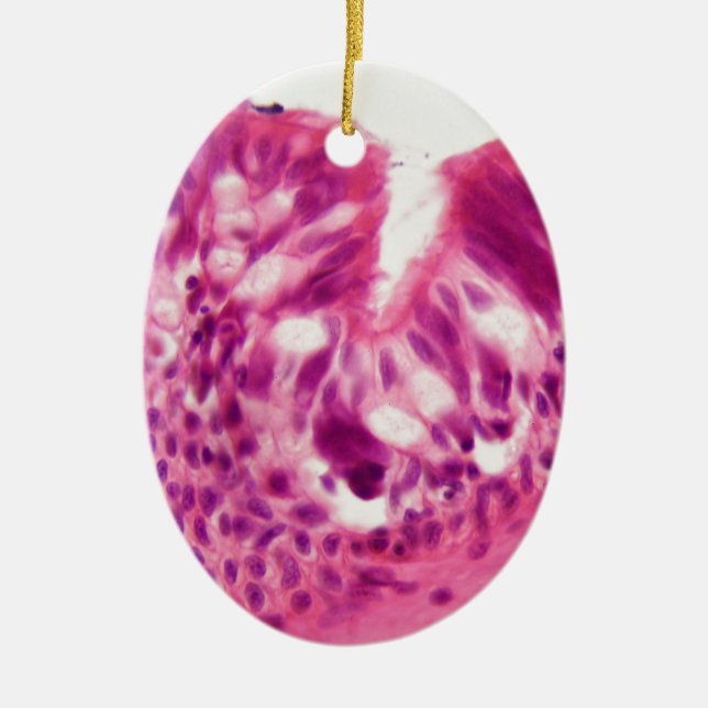 Ornamento De Cerâmica Epitélio Ciliated sob o microscópio (Frente)