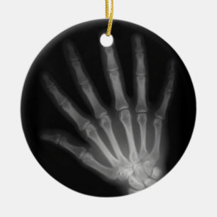 Ornamento De Cerâmica Mão Direita de raio X Extra Digit