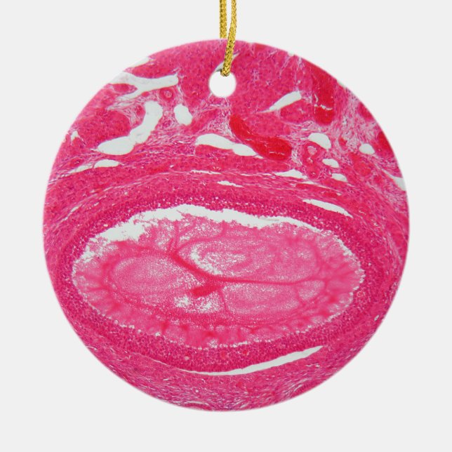 Ornamento De Cerâmica Pilhas do ovário sob o microscópio (Frente)