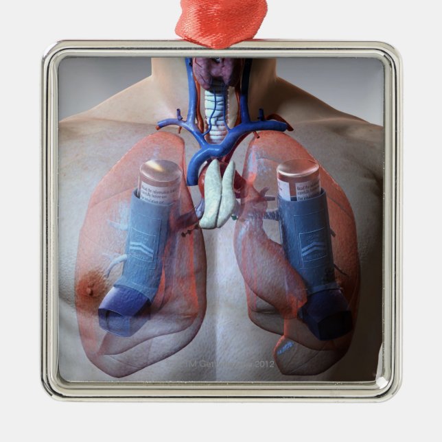 Ornamento De Metal Asma (Frente)