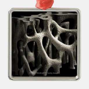 Ornamento De Metal Estrutura de um osso com osteoporose