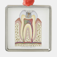 Ilustração da deterioração de dente