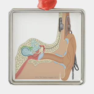 Ornamento De Metal Implantes cocleários