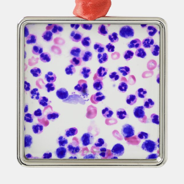 Ornamento De Metal Infecção do Staph (Frente)