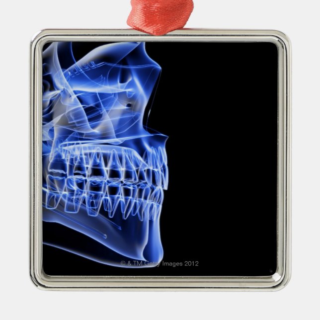 Ornamento De Metal Ossos da maxila (Frente)