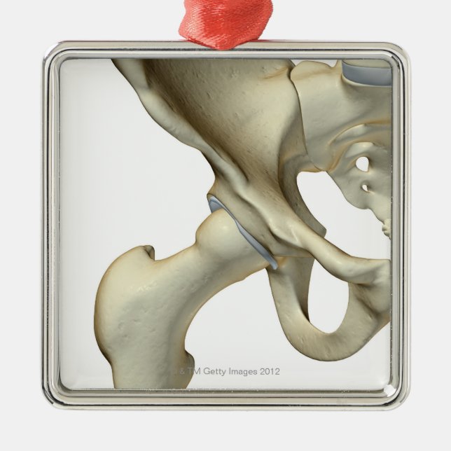 Ornamento De Metal Ossos do quadril 5 (Frente)