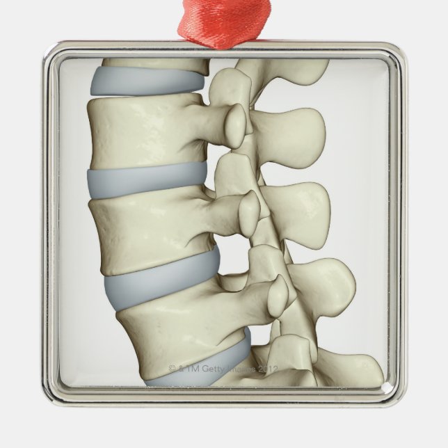 Ornamento De Metal Vértebras lombares (Frente)