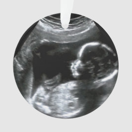 Ornamento Presente de Imagem do Sonograma do Bebê Natal
