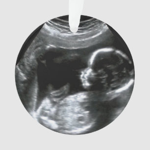 Ornamento Presente de Imagem do Sonograma do Bebê Natal