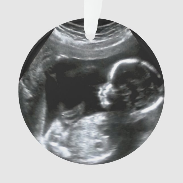 Ornamento Presente de Imagem do Sonograma do Bebê Natal (Frente)