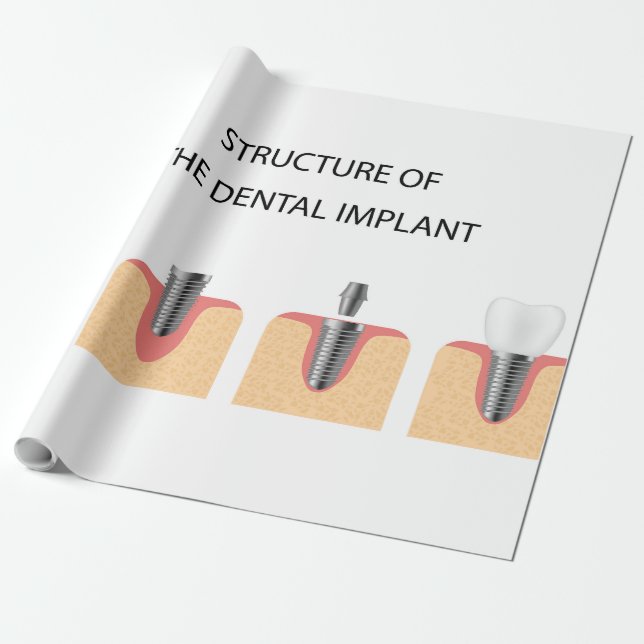 Papel De Presente Estrutura do implante dental (Desenrolado)