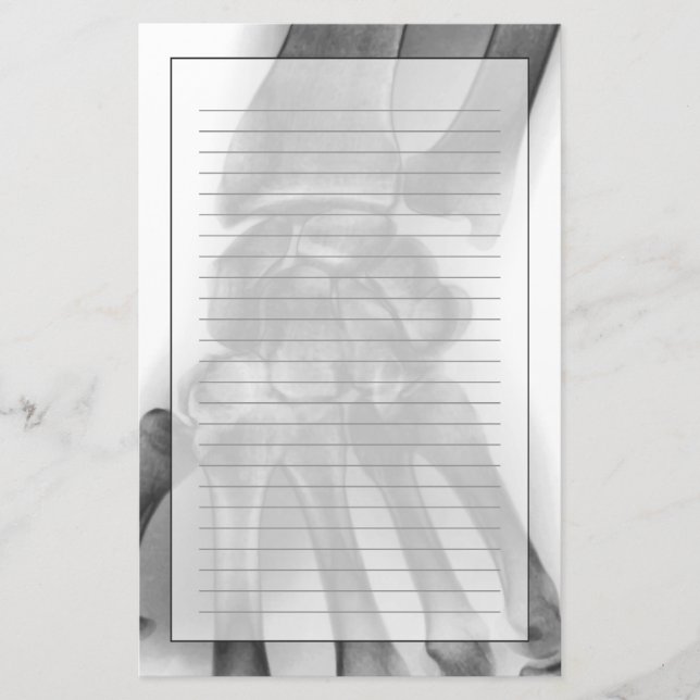 Papelaria Pulso normal, raio X (Frente)