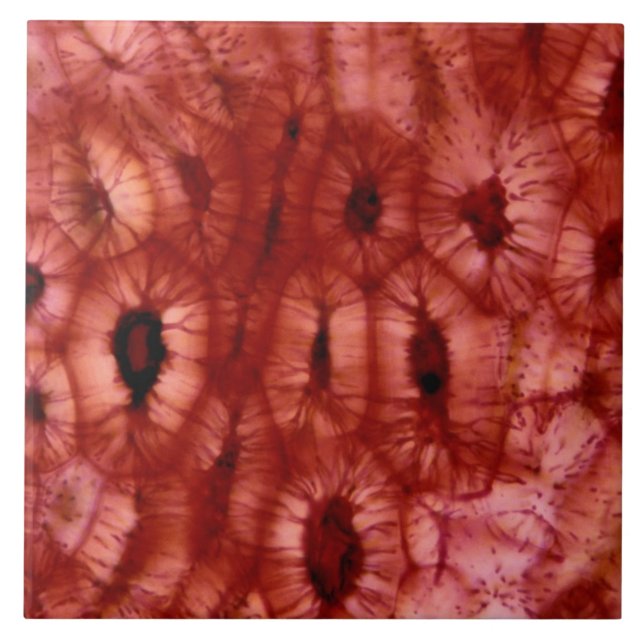 Pilhas de Sclerenchyma de um poço da cereja (Frente)