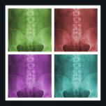 Pop de arte digital em raio-x Poster<br><div class="desc">O design apresenta quatro versões coloridas diferentes de um raio-x ap lumbopelvic incorporado e melhorado digitalmente.</div>