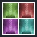 Pop de arte digital em raio-x Poster<br><div class="desc">O design apresenta quatro versões coloridas diferentes de um raio-x ap lumbopelvic incorporado e melhorado digitalmente.</div>