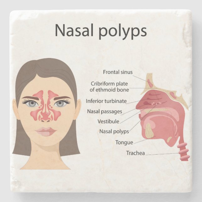 Porta-copo De Pedra Sinse sobre fundo branco (Frente)