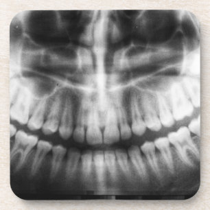 Porta-copo Dentes de Raio X Sorriem Preto e Branco