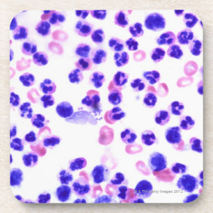 Porta-copo Infecção do Staph