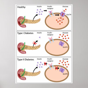 Poster A ação e o diabetes da insulina datilografam - o