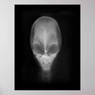 Poster Alienígena Skull X-ray