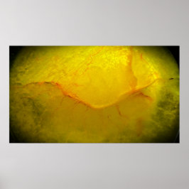 Poster Amarelo Abstrato,