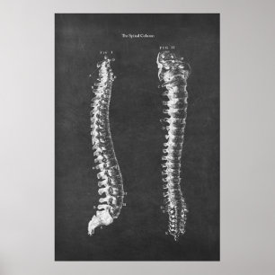 Poster Anatomia da coluna vertebral Arte Física da Terapi