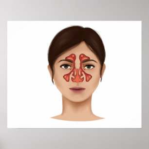 Pôster Anatomia Dos Sinus Nasais