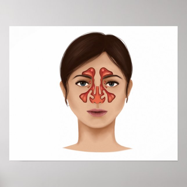 Pôster Anatomia Dos Sinus Nasais (Frente)