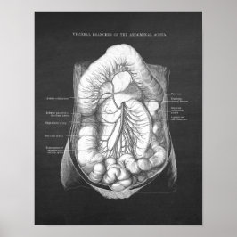Poster Aorta Abdominal Anatomia