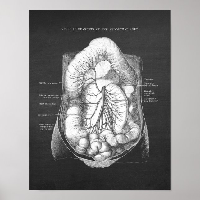 Poster Aorta Abdominal Anatomia (Frente)