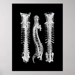 Poster Arte da Anatomia da coluna