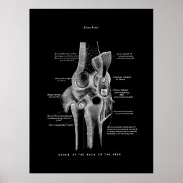 Poster Artes do joelho Anatomia