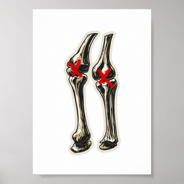 Poster Bad Knees – Funny Skeleton Knee Illustration (Frente)