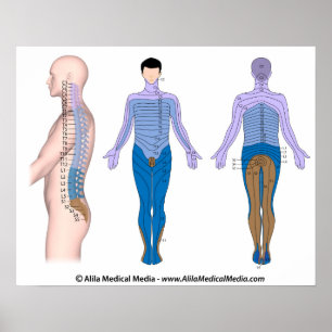 Poster Base de ferimento da medula espinal, desenho