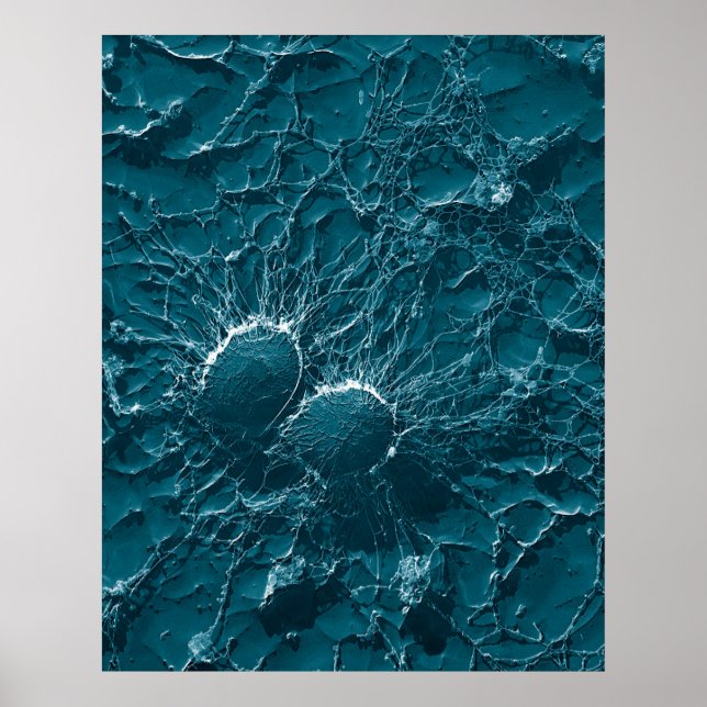 Pôster Células bacterianas de Staphylococcus Aureus fecha (Frente)